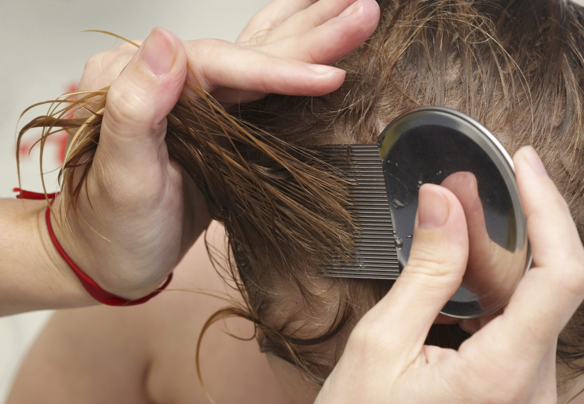 Hair Dyeing Before Head Lice Treatment: A Must-Know Hack!