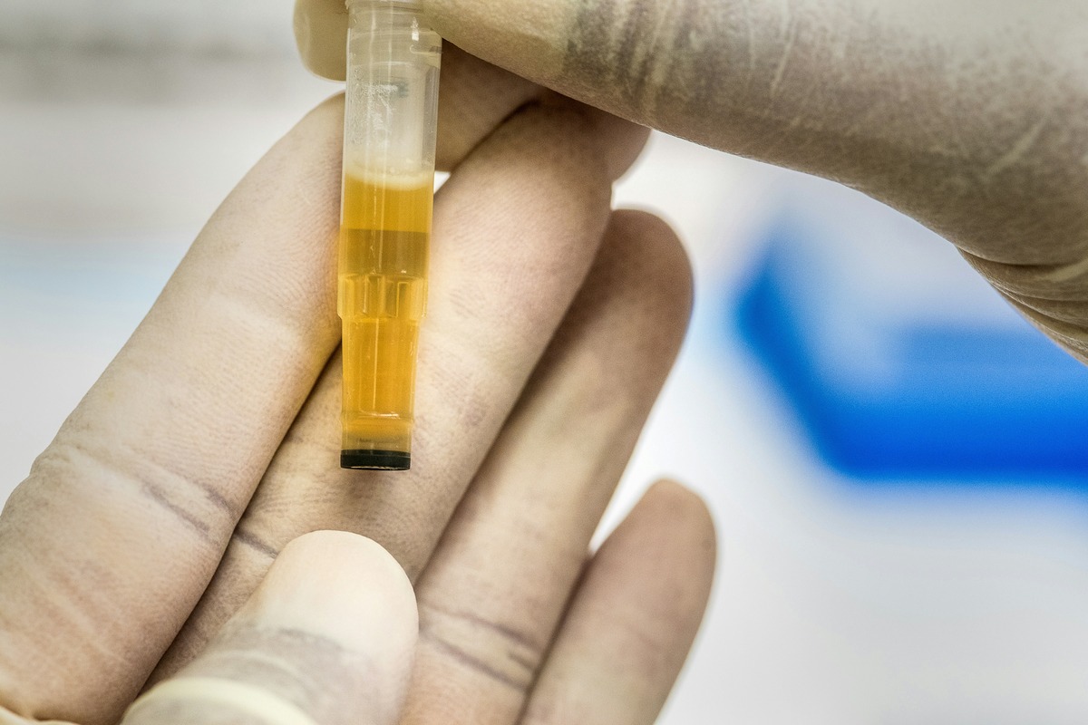 Shocking Discovery: The Surprising Truth About Urine Storage Revealed!