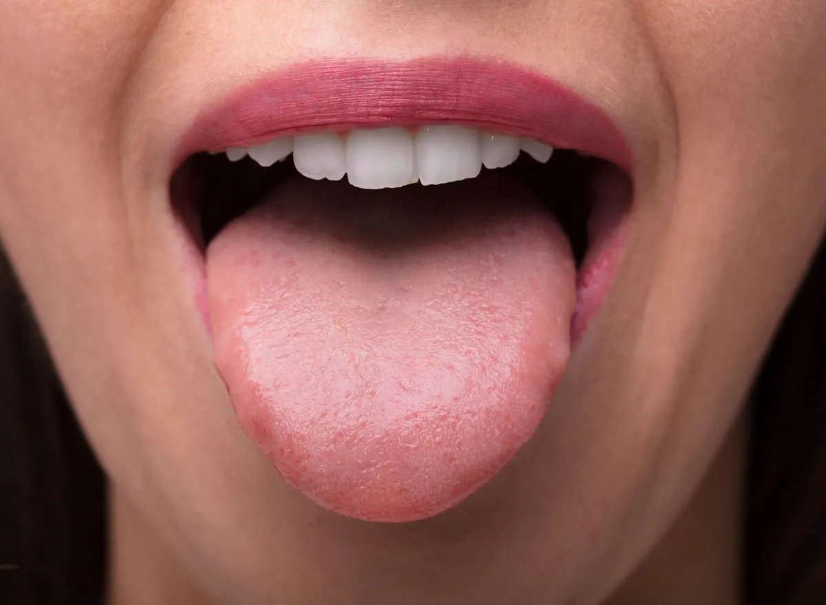 The Surprising Truth About The Taste Of Pee: You Won’t Believe Your Taste Buds!