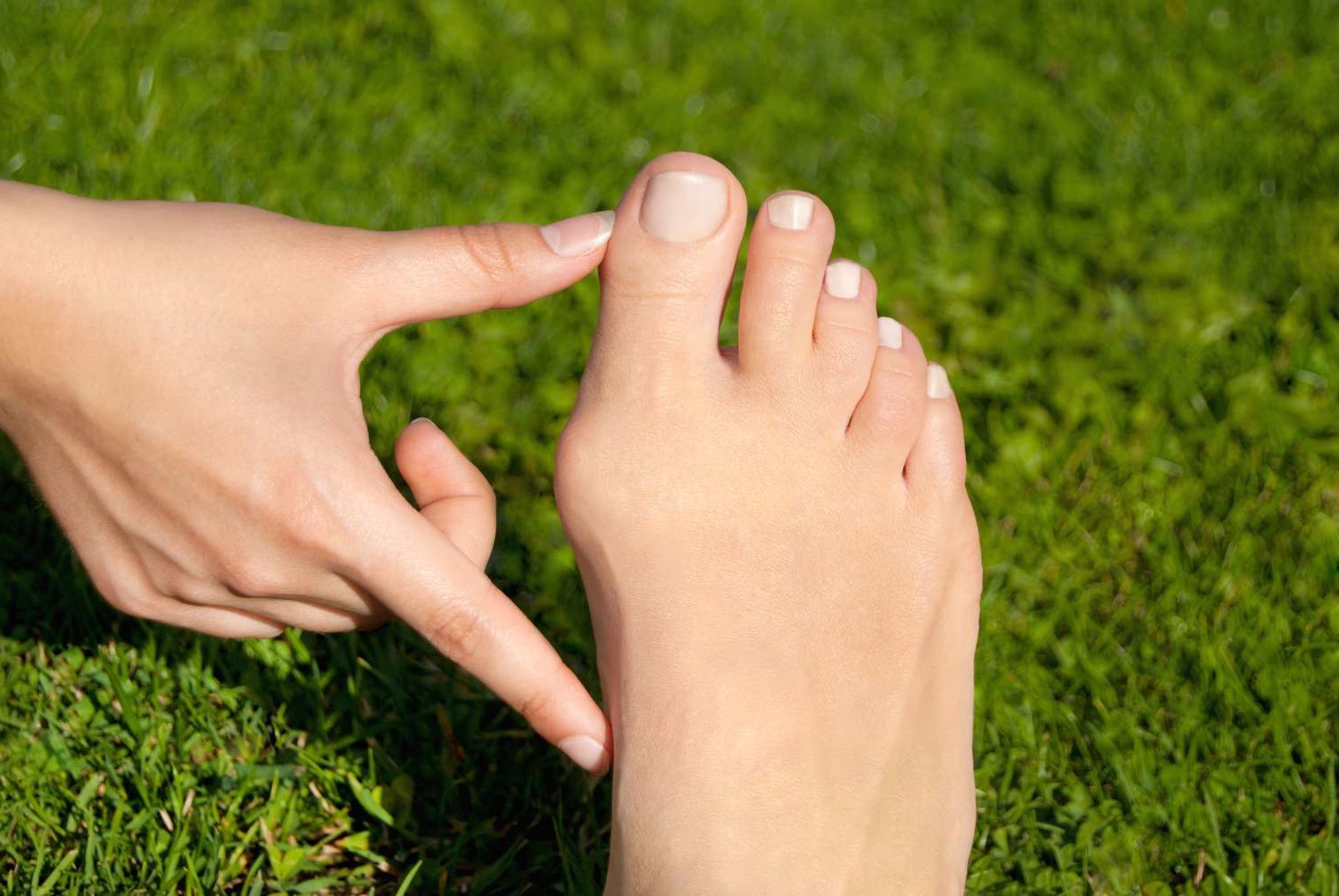 How To Shrink Bunions Naturally