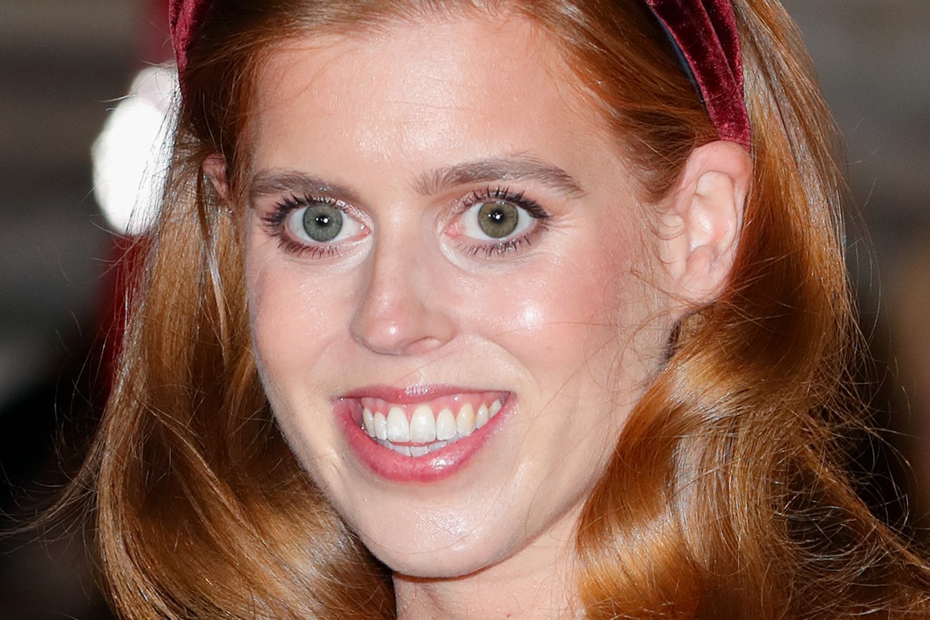 Princess Beatrice's Eye Condition: What You Need To Know