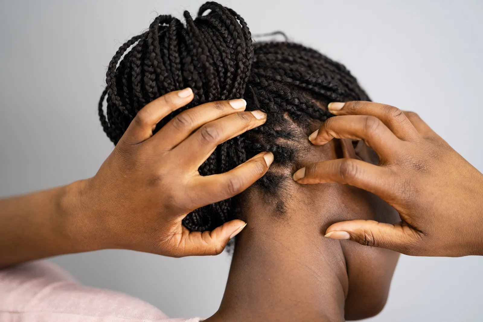 Surprising Truth: Lice And African Americans - What You Need To Know